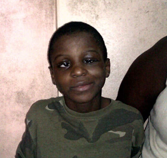 Paul-Lewis Abali var heldig og fikk tilbake synet etter en operasjon som ble støttet av Right to Sight. Over 18 millioner mennesker lider av grå stær, men det kan behandles.