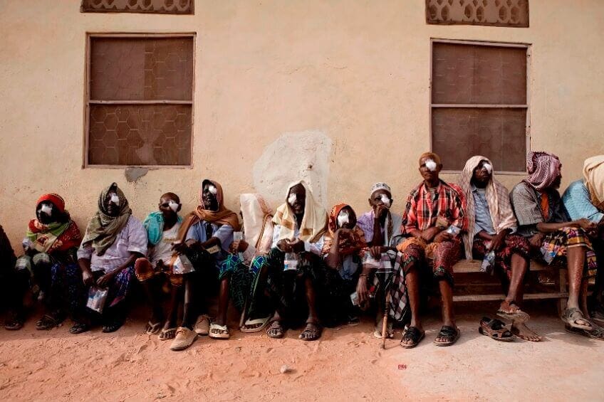 Nyopererte mennesker i Kenya