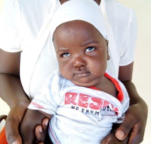 Liten gutt med grå stær